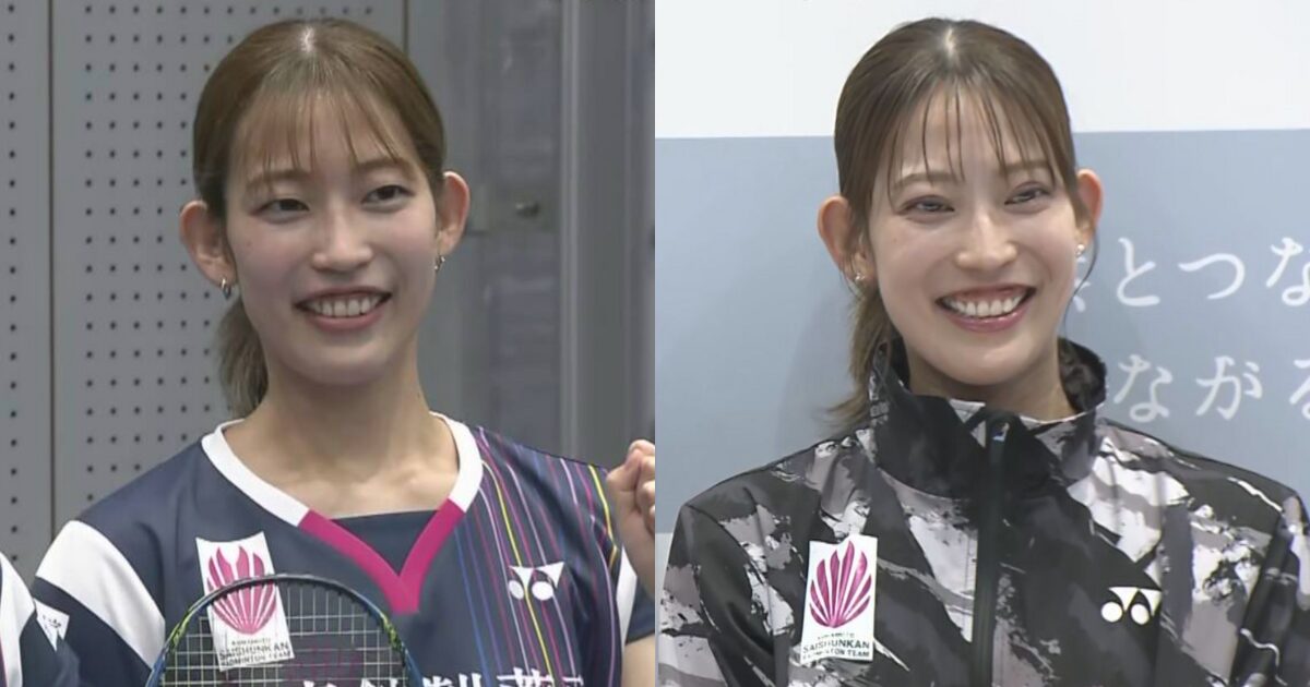 シダマツペア,松山奈未,整形