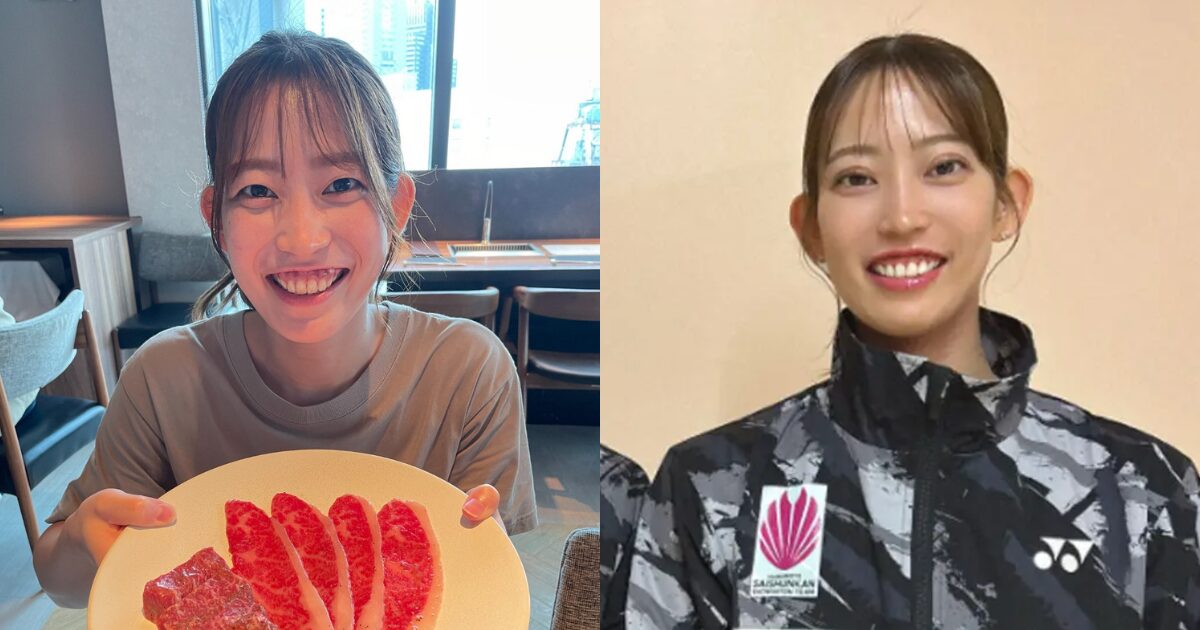 シダマツペア,松山奈未,整形
